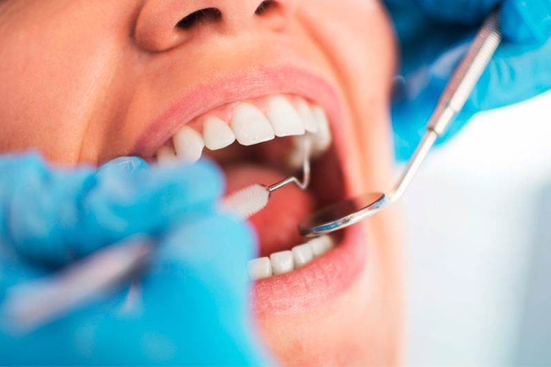 Lesões Cancerizáveis da Cavidade Bucal O que é importante para Concursos de Odonto