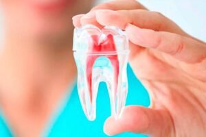 Aprenda diagnóstico em endodontia: fundamentos, classificação e aplicação clínica para identificar corretamente alterações pulpares e periapicais.