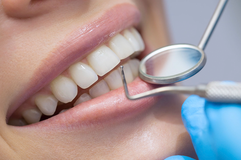 Resolução de Questões de Concurso de Odonto da Banca IMAM